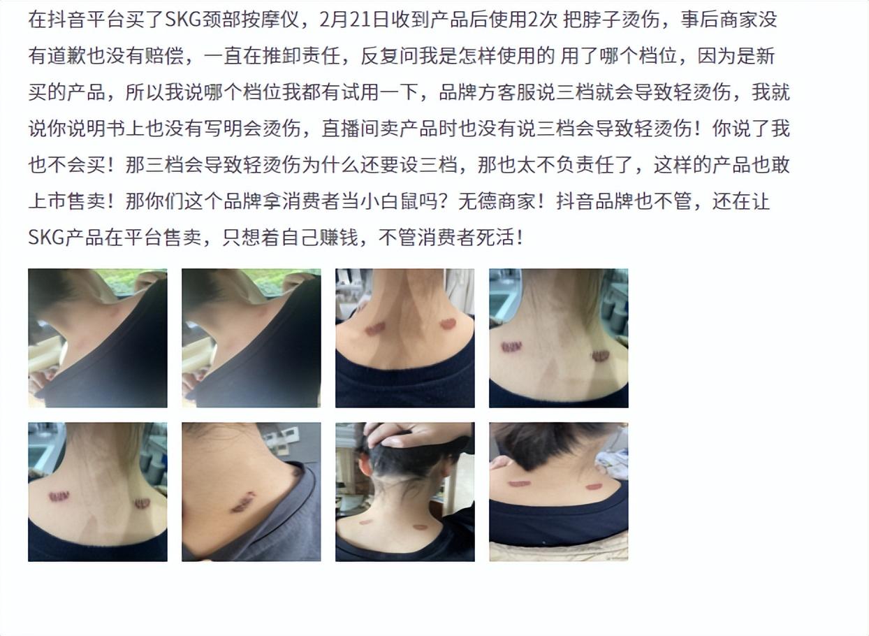 SKG是什么品牌？分享skg品牌介紹及產(chǎn)品質(zhì)量優(yōu)勢分析