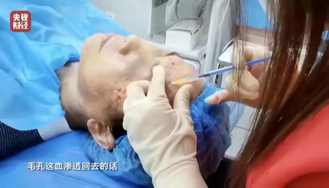 2023年315晚會曝光事件（2023年315打假產(chǎn)品案例分析）