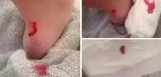 為什么一只鞋磨腳一只不磨？（鞋后跟磨腳的小妙招）